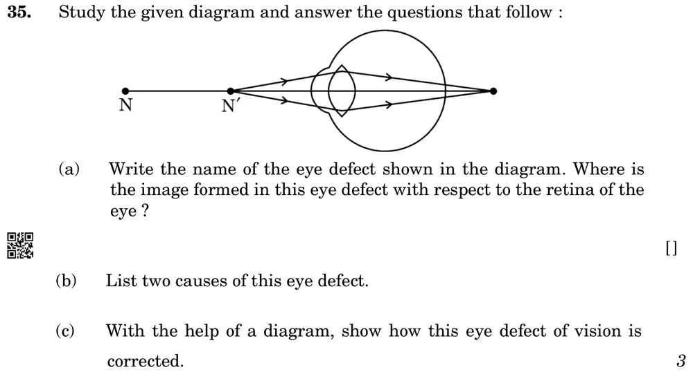 Study the given diagram and answer the questions that follow:
(a) Write the name of the eye defect shown in the diagram. Figure: An object at N' (closer than the near point N of a normal eye) sends rays into the eye; they converge at a point behind the retina.